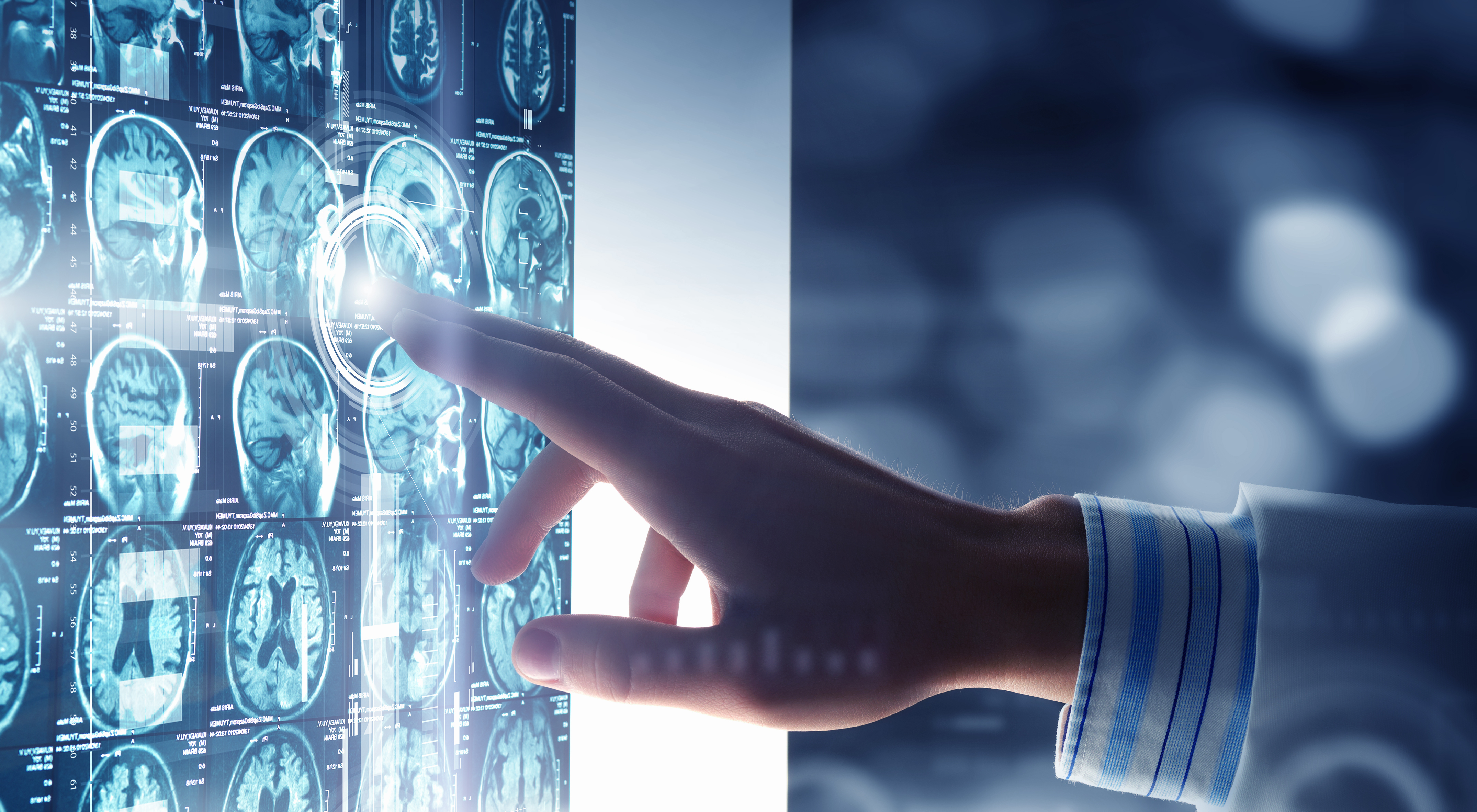 Basics of Magnetic Resonance Imaging